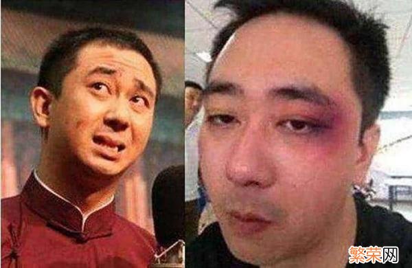 北京包丽丽事件 包丽丽事件的结果