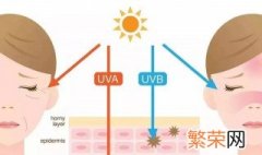 皮肤晒伤后美白的方法 皮肤晒伤后美白的方法分享