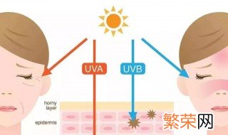 皮肤晒伤后美白的方法 皮肤晒伤后美白的方法分享