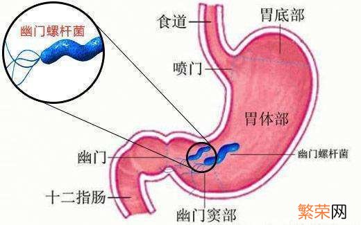 患幽门螺杆菌能接吻吗