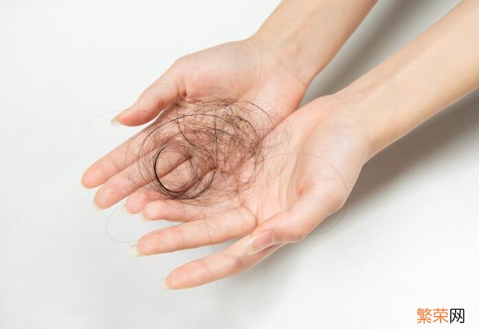 脱发是什么原因引起的 为什么会掉头发