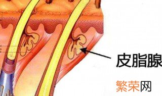 皮脂腺分泌旺盛怎么办 皮脂腺分泌旺盛解决方法