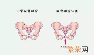 耻骨在哪个位置 耻骨的位置