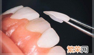 美白牙齿最有效的方法 有什么改善的技巧