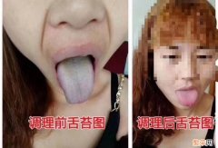 女人口臭什么原因引起，严重了是身体哪里出问题了？怎样去除