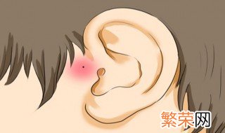 耳朵烫代表什么预兆 耳朵烫代表哪些预兆