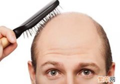男性脱发是什么原因引起的 男性脱发是什么原因引起的怎么办