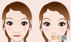 眉间纹怎样去掉 多种方法解决眉间纹