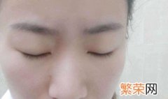 淡化痣的小妙招 淡化痣的小妙招是什么