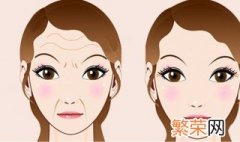 如何消除眉间纹 消除眉间纹的方法