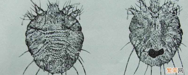 疥虫怎么灭干净 如何清理房间疥虫