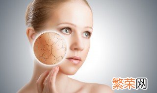 角质层薄怎么修复 角质层薄如何修复