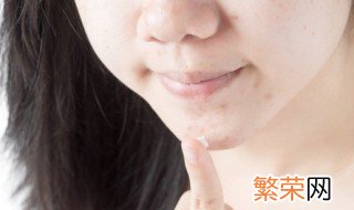 怎么去除脸上的痘坑痘印 去除脸上的痘坑痘印的方法
