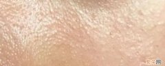 什么是油皮 什么是油皮肤什么是干皮肤