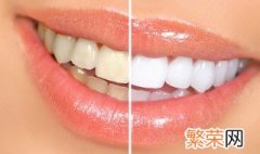 黄牙怎么变白牙 黄牙变白的方法