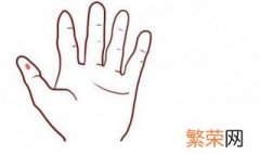 手指有痣代表什么意思 手指有痣有什么含义