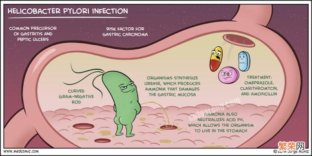 幽门螺旋杆菌70%的人都有,吃什么能消灭它？