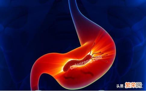 这3种食物是幽门螺杆菌的“敌人”,平时多吃点,胃病都会绕路走!“敌人”指什么?