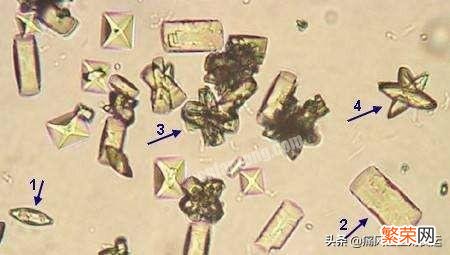 痛风患者长期喝苏打水行不行？