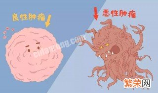 身上的黑色素越来越多是怎么回事 身上黑色素越来越多什么原因