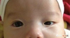 婴儿出生后,一只眼大一只眼小怎么办？
