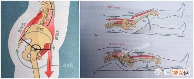 走路能够改善骨盆前倾吗？