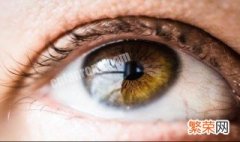 眼袋大是什么原因 眼睛浮肿眼袋大是什么原因