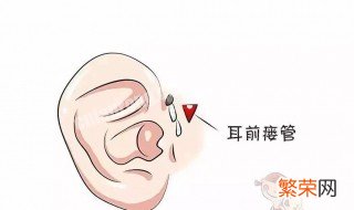 耳屎是怎么形成的 耳朵耳屎是怎么形成的