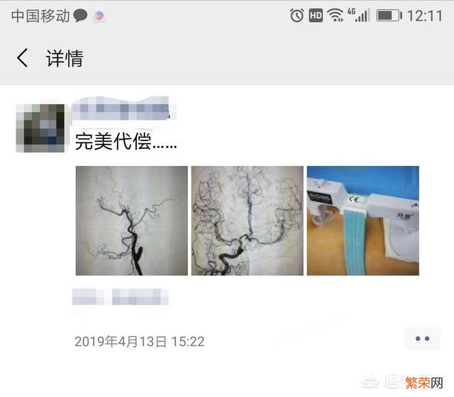 各位觉得医生把患者病例图片发往朋友圈的做法是否妥当？