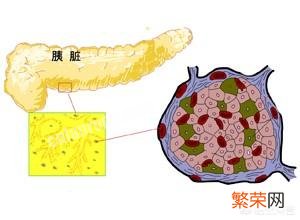 世界各国糖尿病人越来越多,未来的医学发展,能彻底根治糖尿病吗？