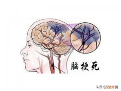 为什么很多病人都脑梗了送到医院,医生还只是简单的拍个片输个液？