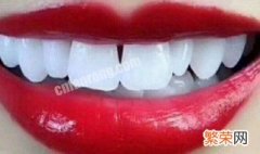 牙齿怎么才可以变白 牙齿变白的快速小秘方