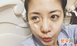 女生提亮肤色最好的方法 女生提亮肤色简单方法如下