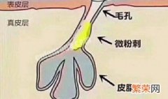 清理毛孔方法 怎么清理毛孔