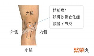 髌骨是哪个部位图片 髌骨是哪个部位