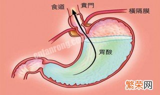 有点胃酸怎么办 有点胃酸怎么办,吃什么食物养胃?